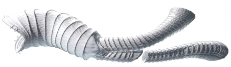 Aorfix AAA Stent Graft